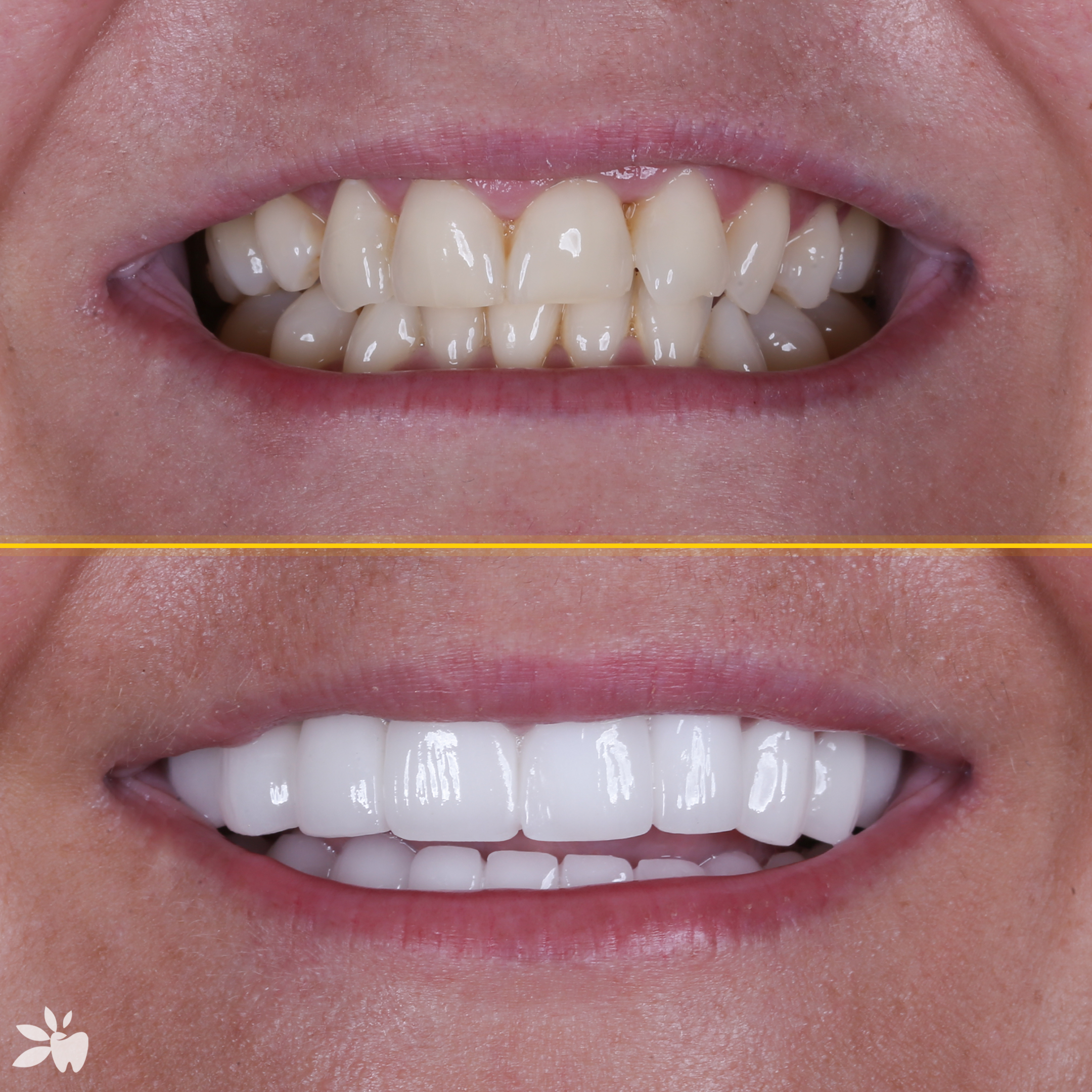 Andrea-before-after
