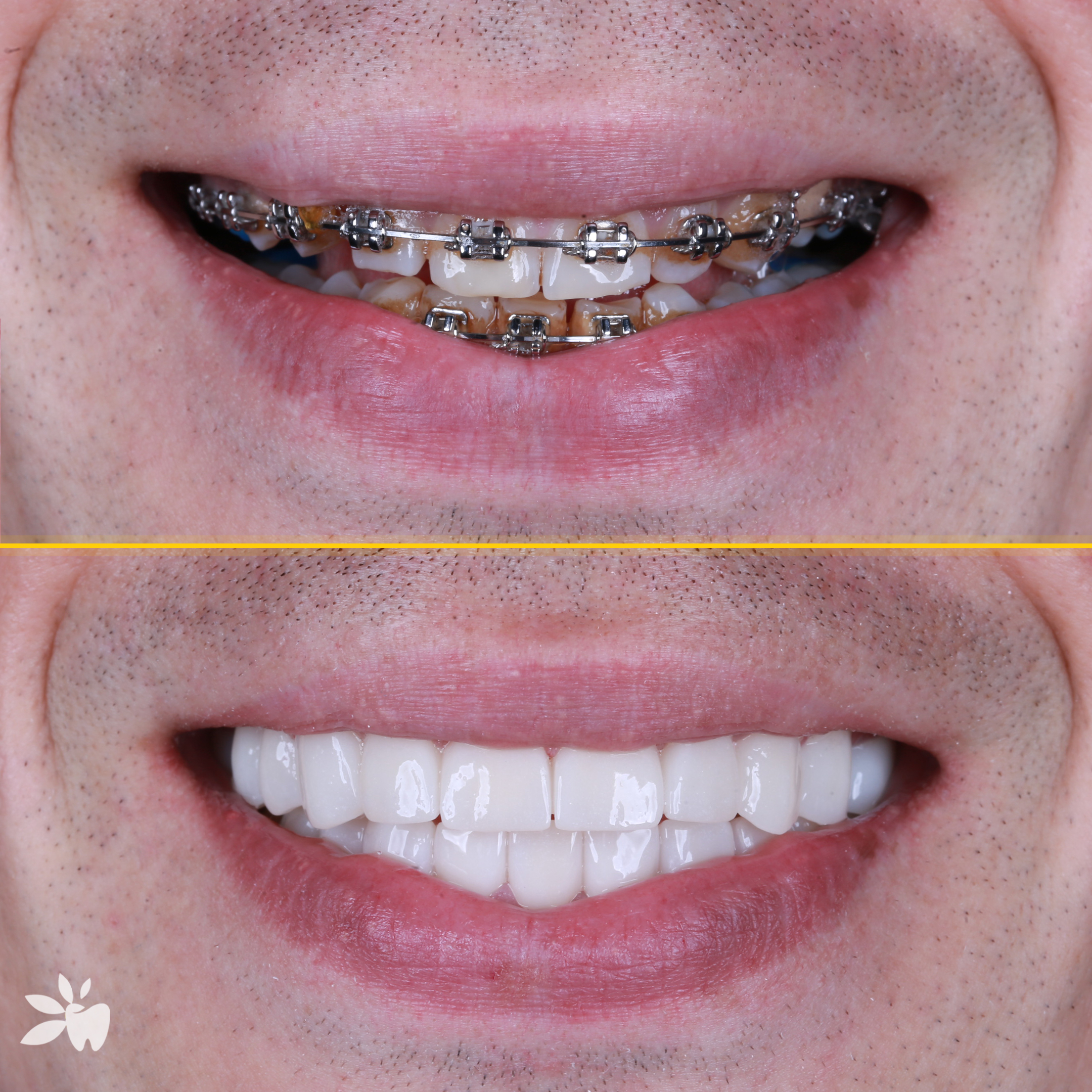 Borys-before-after-post