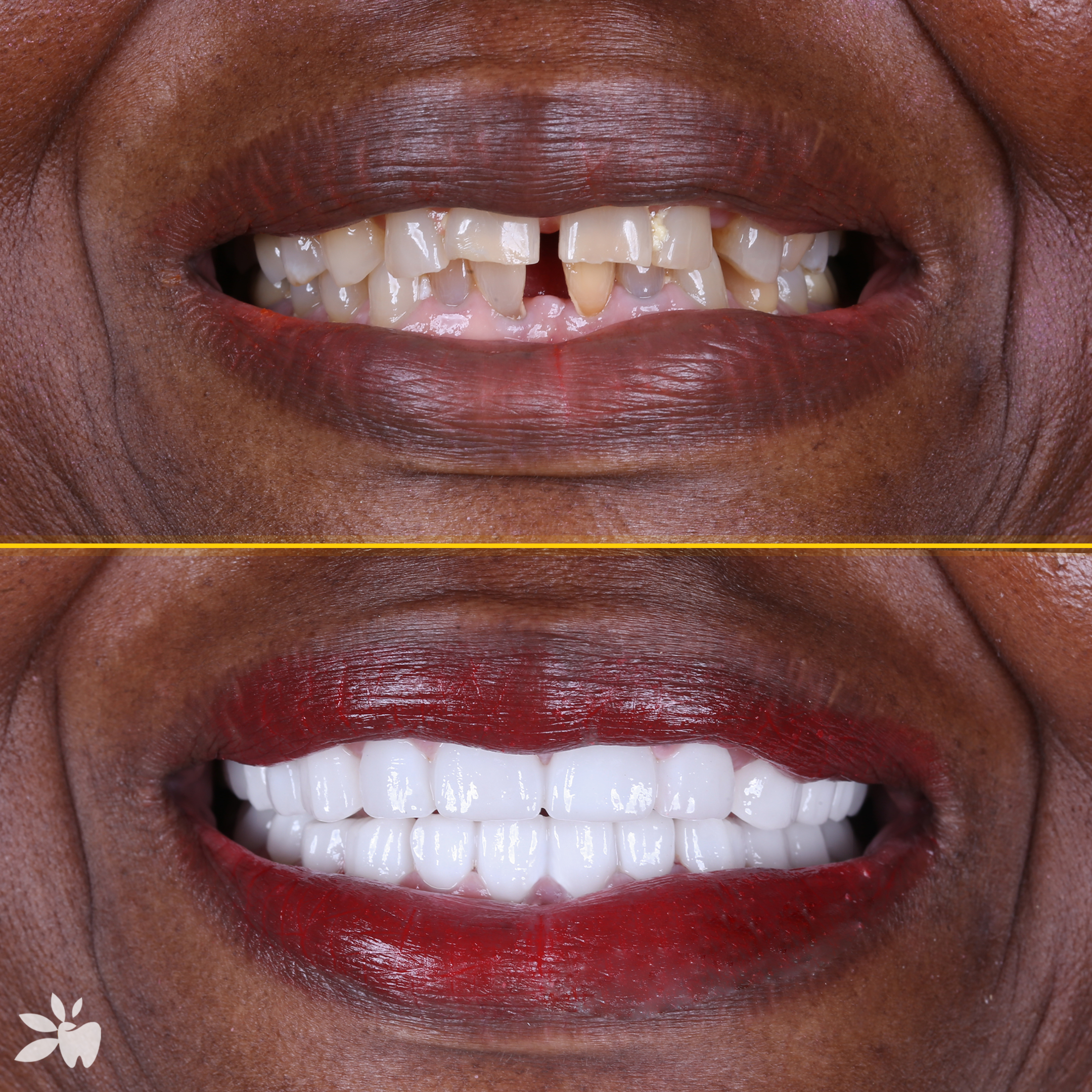 Claudian-before-after-3