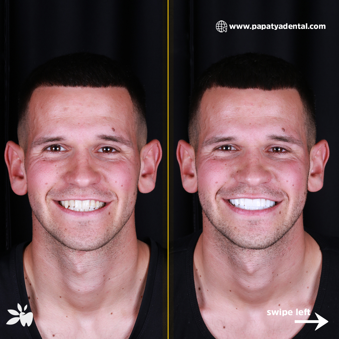 James-before-after-face