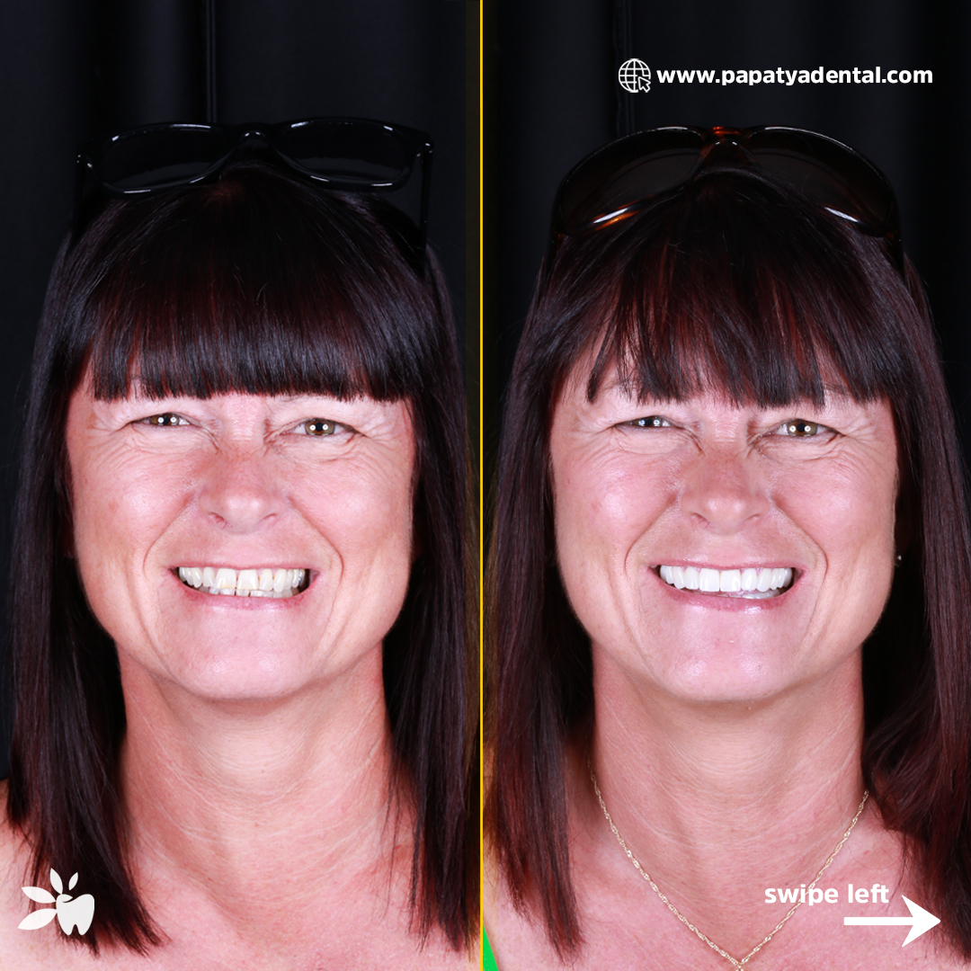 Kirsty-before-after-face