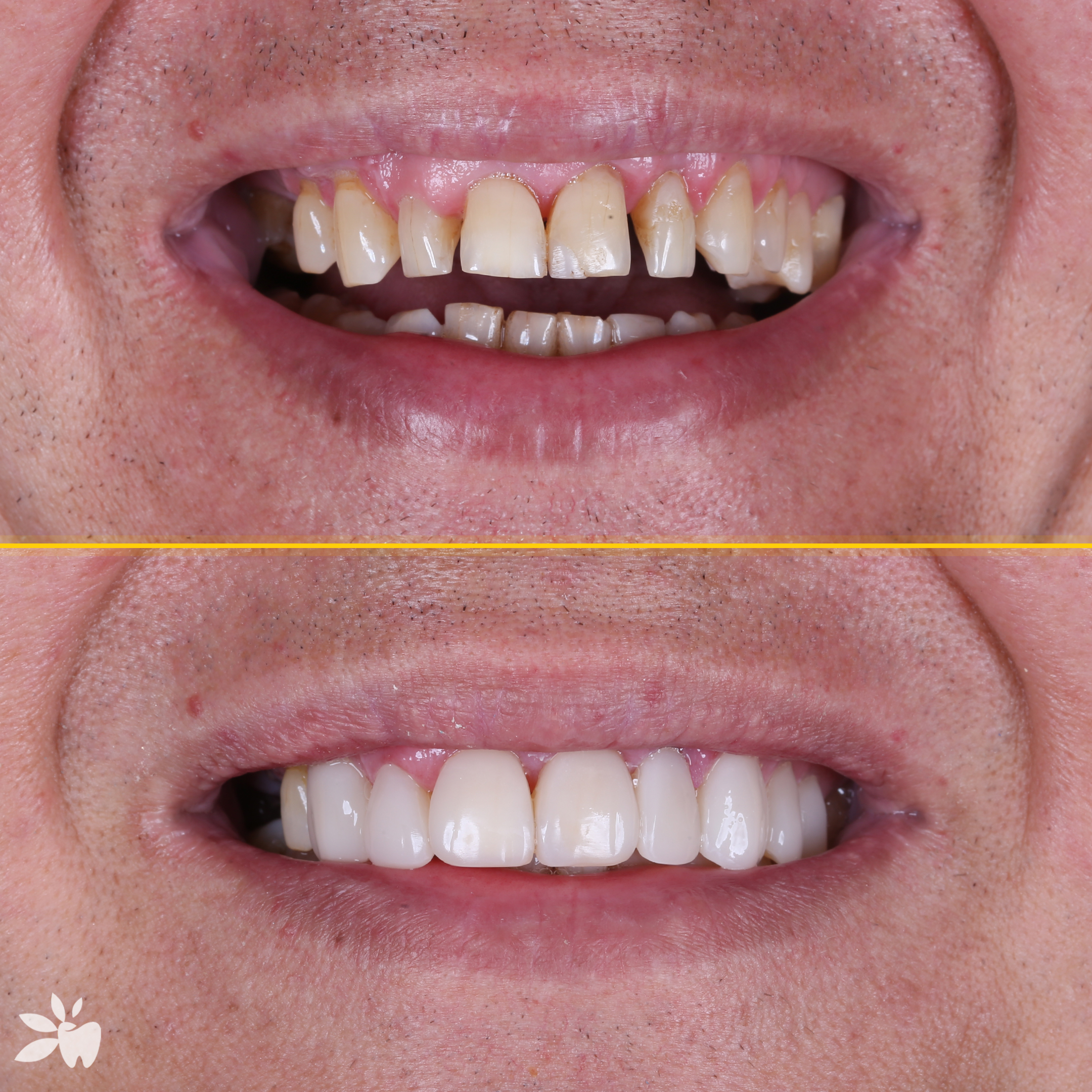 Marek-before-after