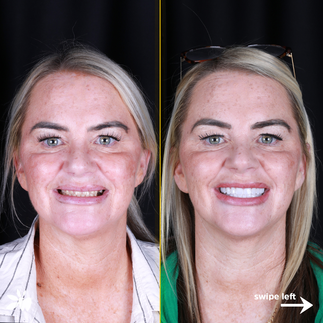 Maria-before-after-face