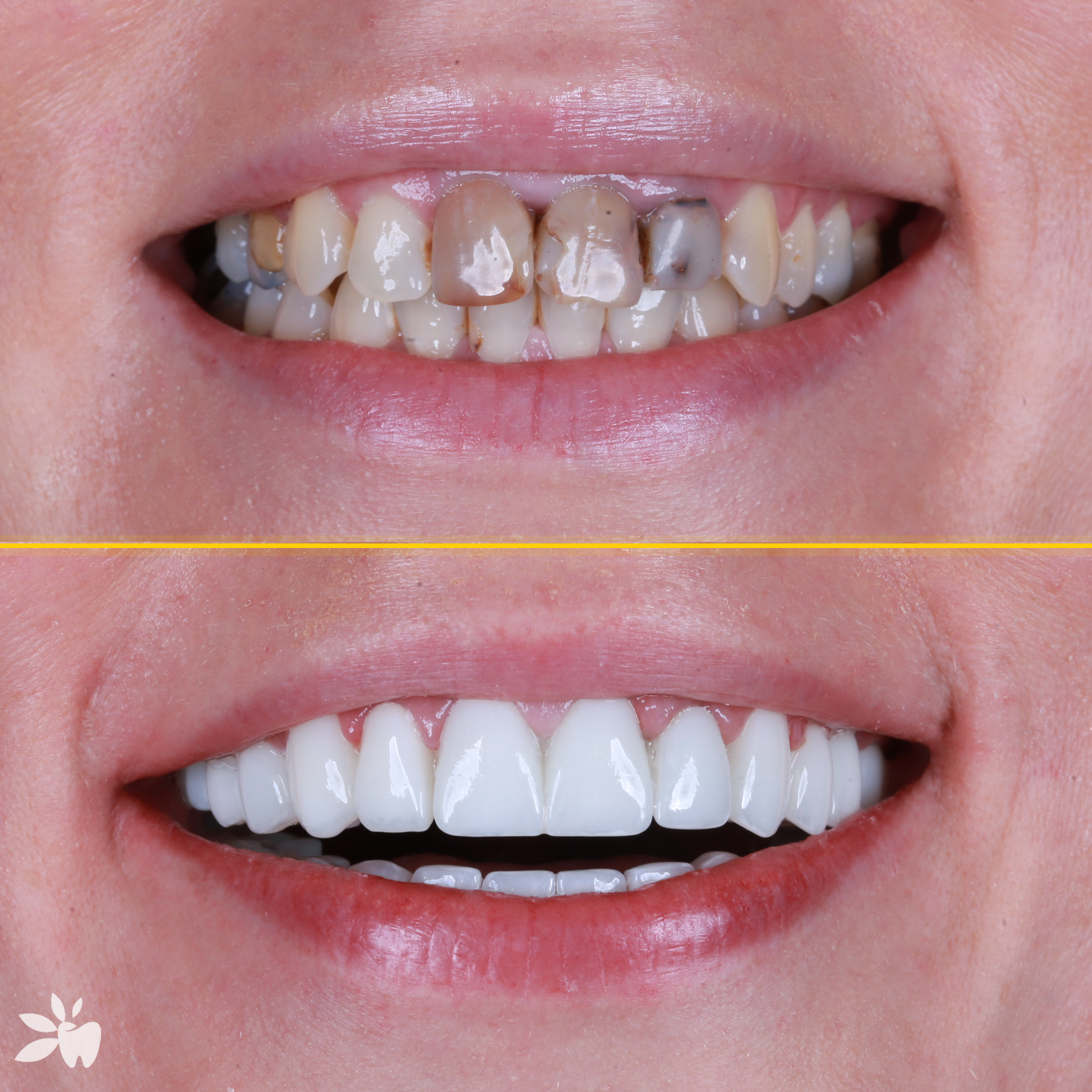 Paulina-before-after
