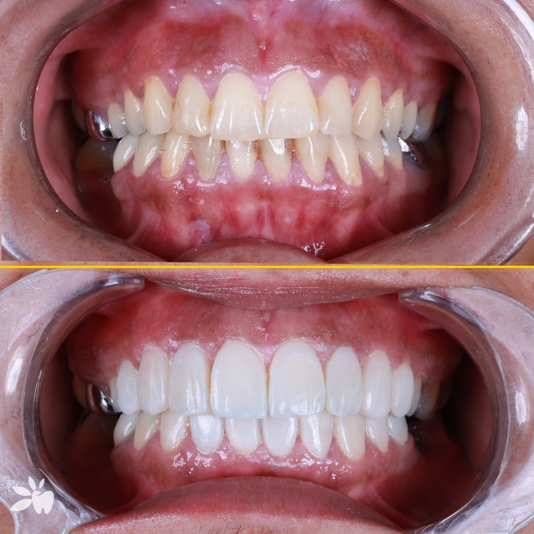 Rabia-before-after-post