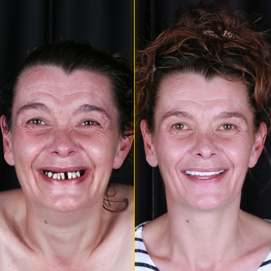 Rebecca-before-after-face