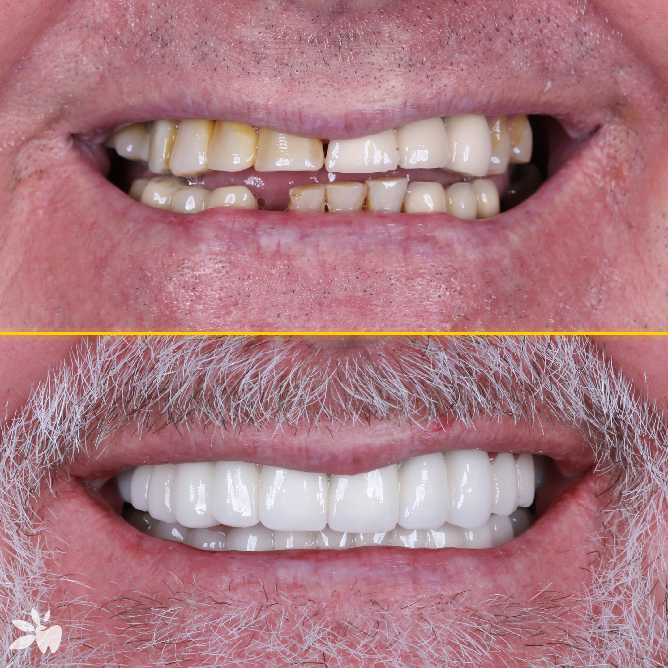 Robert-before-after