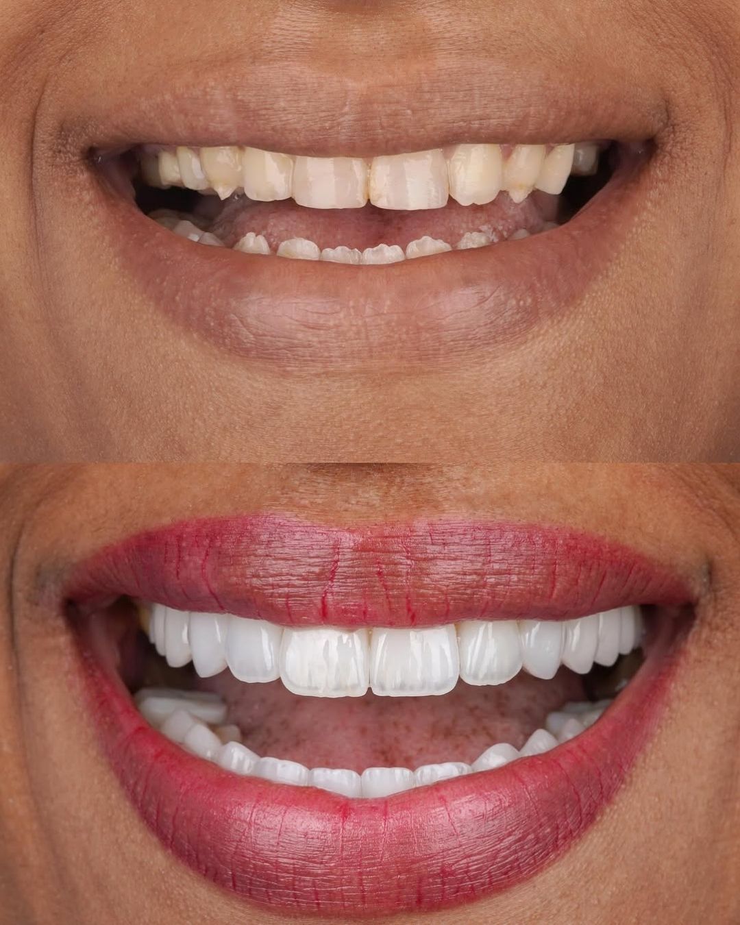 Smile Image